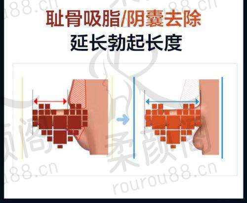 技术与理念引进
