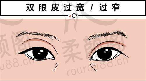 石家庄蓝山医疗美容医院靠谱吗？成立多年口碑好，医生经验丰富能开展多项目