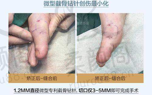 南昌同济美容医院2025年价格参考