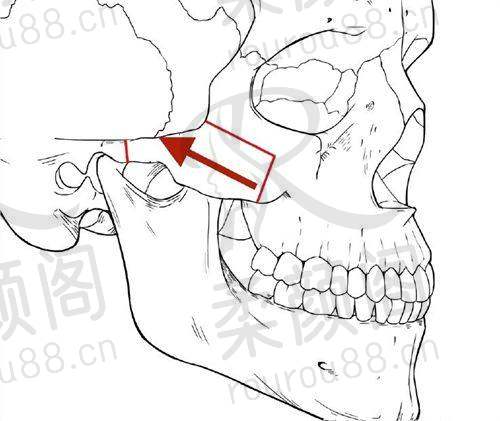 江西俏佳人医疗美容门诊部靠谱吗？当地规模大、成立久，多种整形项目口碑好