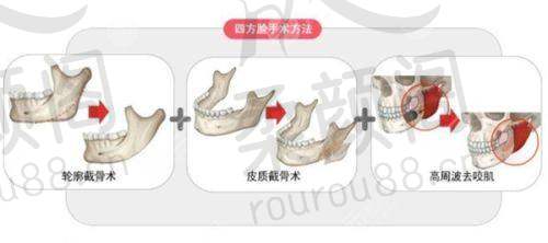 上海仁爱医院2025年价格表