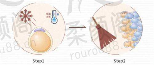 门诊部开展项目之肋软骨隆鼻